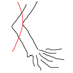 scion or seedling/sapling tree