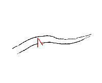 Notching Branches