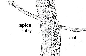 threadgrafting bonsai